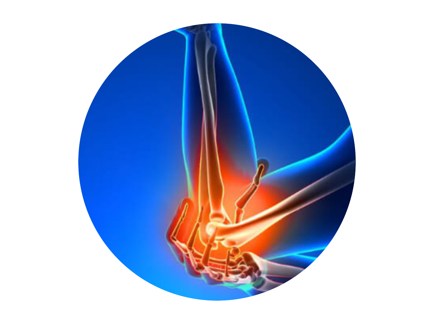 Upper Extremity, Elbow to Hand, Meriwether's Maximum Therapy, Chad Meriwether Chiropractor, Aledo, Texas